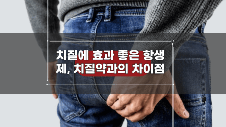 치질에 효과 좋은 항생제, 치질약과의 차이점